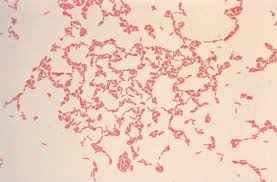 Image result for Pseudoeriosema