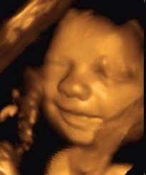 Pin On Week By Week Pregnancy