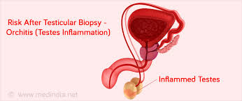 The migration is complete at ~30 weeks. Testicular Biopsy Types Procedure Precautions Risks Results