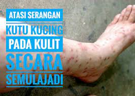 Memelihara anak kucing tak berinduk di bawah usia tiga minggu. Cara Mengatasi Serangan Kutu Kucing Pada Manusia Secara Semulajadi Serimuslimah Sihat