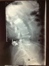 World Journal of Clinical Cases