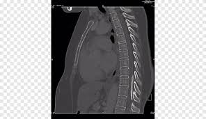Radiology Autosomal Dominant Polycystic Kidney Disease Radiopaedia Medical Diagnosis Swamy Medical Diagnosis Medical Png Pngegg Download the latest version of radio garden for android. pngegg