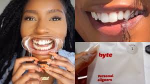 How long should i wear retainers a day? Fixing My Teeth Affordable Aligners To Straighten Teeth My Byte Journey Iamlindaelaine Youtube