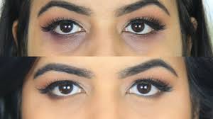 Image result for dark circles