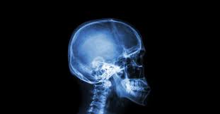 Read about concussion symptoms, signs, test, postconcussion syndrome, and treatment. 7 Career Saving Strategies For Sport Concussion Management