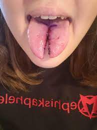 Fresh Tongue Split Bodymods