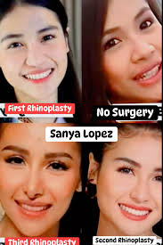 I like the old noses. Thoughts? #KyleRichards #deniserichards #lisarinna  #GarcelleBeauvais #DoritKemsley #erikajayne #suttonstracke #jennifertilly  #TeddiMellencamp #LVP #CamilleGrammer #yolandahadid #kathyhilton #bravotv  #RHOBH #adriennemaloof ...