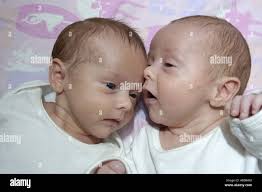 Fraternal twin hi-res stock photography and images