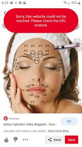 Pin de tosha Steele en botox