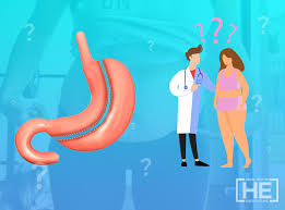 After gastric bypass surgery, you will have five or six small incisions that need to be cared for in the days and weeks after gastric bypass scars: How To Prevent Loose Skin After Gastric Sleeve Surgery Dr He Obesity Clinic