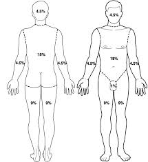 Rules Of Nines Chart Rule Of Nines Chart Child Lund And