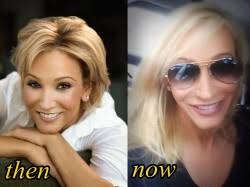 Firstly, vanna could have gotten a a facelift which was combined with filler injection like botox. Jinkee Pacquiao Plastic Surgery Before And After Plastic Surgery Hits