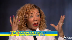 Qu'il s'agisse du tatouage ou du laser, l'inoffensivité des procédés chirurgicaux auxquels recourent les spécialistes pour modifier la couleur de l'iris reste «les résultats sont très décevants. Changer La Couleur Des Yeux Tunisie Choix De Couleur