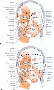 Image result for Botulinum Toxin Injection