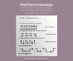 Wochenfluss hatte ich nur 3 wochen lang und jetzt hab ich scho die erste periode bekommen. Narbenmassage Nach Kaiserschnitt Kaiserschnitt Massage Kaiser