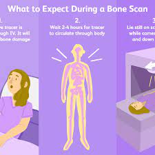 Let us know if you have suggestions to improve this article (requires login). Bone Scans Uses Side Effects Procedure Results