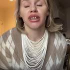 Why does Lauren Cameron Glass wear fake teeth she got from a Halloween  store? : r/tiktokgossip