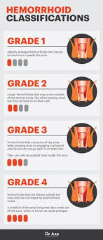 Hemorrhoid Classifications Dr Axe Getting Rid Of Hemorrhoids Hemorrhoid Remedies Home Remedies For Hemorrhoids