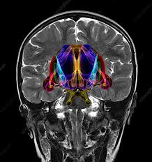 Image result for Limbic System