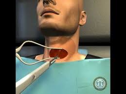 Artificial Disc For Cervical Disc Replacement Are You Aware Cervical Disc Replacement Surgery Is Designed T Cervical Disc Herniated Disc Exercise Neck Surgery