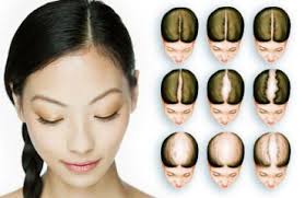 Tetapi ia lebih kerap dialami kaum wanita. 10 Petua Rambut Gugur Untuk Lelaki Toppik Malaysia