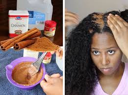 Amplixin Intensive Biotin Hair Growth Serum Reviews Super Fast Hair Growth Mask For All Hair Types Hair Mask For Growth Extreme Hair Growth Cinnamon Hair