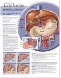 Amazon Com Understanding Liver Cancer Anatomical Chart