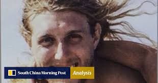 Hero firefighter gets the most incredible face transplant yet, covering  almost entire head