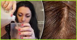 Apple cider vinegar is mostly apple juice, but adding yeast turns the sugar in the juice into alcohol. How To Use Apple Cider Vinegar To Cure Dandruff Benefits Side Effects