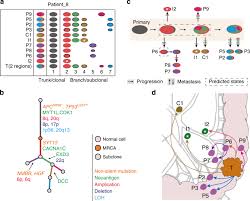 Sometimes the blood can make the faeces turn a very dark colour. Mapping The Spreading Routes Of Lymphatic Metastases In Human Colorectal Cancer Nature Communications
