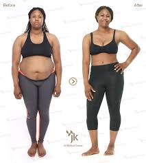 Pin On Korean Body Contouring Surgery
