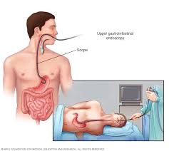 Comment se passe une fibroscopie ? Endoscopie Coloscopie Fibroscopie Comment Se Deroule L Examen
