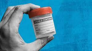 Check spelling or type a new query. 4 Of The Best Home Chlamydia Tests