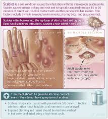 Image result for scabies transmission