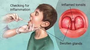 Compared to other cancers, throat cancer is considered to be relatively uncommon. The Difference Between Strep Throat And Tonsillitis