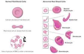 Sel darah merah — eritrosit sel darah putih — leukosit platelets — trombosit. Apa Fungsi Sel Darah Bekam Ke Rumah Kawasan Pasir Gudang Facebook