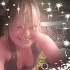 Woman whose skin grew too fast for her body dies at 32