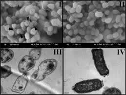 Multistate outbreak of salmonella enteritidis infections linked to ground beef (final update). Characterization Of A Novel Inactivated Salmonella Enterica Serovar Enteritidis Vaccine Candidate Generated Using A Modified Ci857 L Pr Gene E Expression System Infection And Immunity