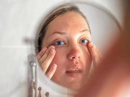 This slang page is designed to explain what the meaning of apple of my eye is. Bulging Eyes Causes Diagnosis And Treatments