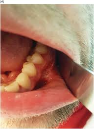 Image result for syphilis ulcer
