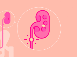 Kidney Stone Kidney Stones Stem Cell Therapy Kidney