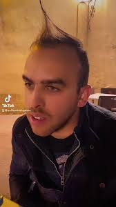 El pelos de mango chupado 🤣😂