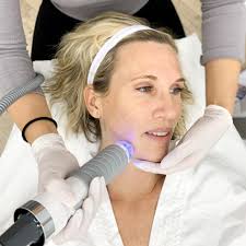 The Three Types of Microneedling