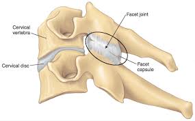 Chiropractic treatment is effective for facet joint syndrome and joint sprain. Talking About Facet Joints B Reddy Org