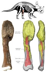 Many forms of malignant cancer may be treated with chemotherapy if caught early. Malignant Cancer Diagnosed In A Dinosaur For The First Time