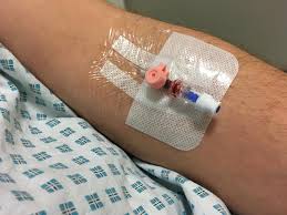 Sepsis and septic shock can result from an infection anywhere in the body, such as pneumonia, influenza, or urinary tract infections. Man Dies Of Sepsis After Hospital Fails To Remove Cannula Australian Doctor Group