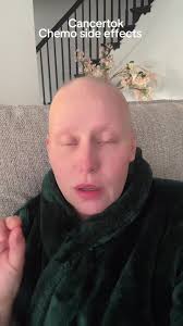 So one of the side effects of the red devil chemo treatment is mouth sores,  and swollen gums. I was lucky for the first round. I did not get it, but  the second round has completely killed my mouth. ...