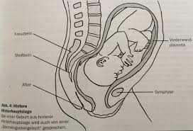 Da sich der kopf ohnehin erst richtig ins becken dreht, wenn die geburt kurz bevorsteht. Ihr Kind Dreht Sich Wie Ein Brummkreisel In Ihrem Becken Besonderheiten Von Sternenguckern Und Was Es Zu Beachten Gilt Hypnobirthing By Mother Birth