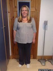 Next to bariatric surgery, nothing is more effective for weight loss than a vlcd, including pills and other diets, says dr. Losing Hair Rapidly With Nearly 2 Stone Still To Go Minimins Com
