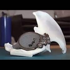China Gets Medical 3d Printing Center Of Excellence Hip Implants Printing Center Medical